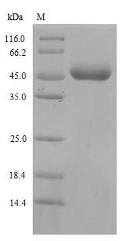(Tris-Glycine gel) Discontinuous SDS-PAGE (reduced) with 5% enrichment gel and 15% separation gel.