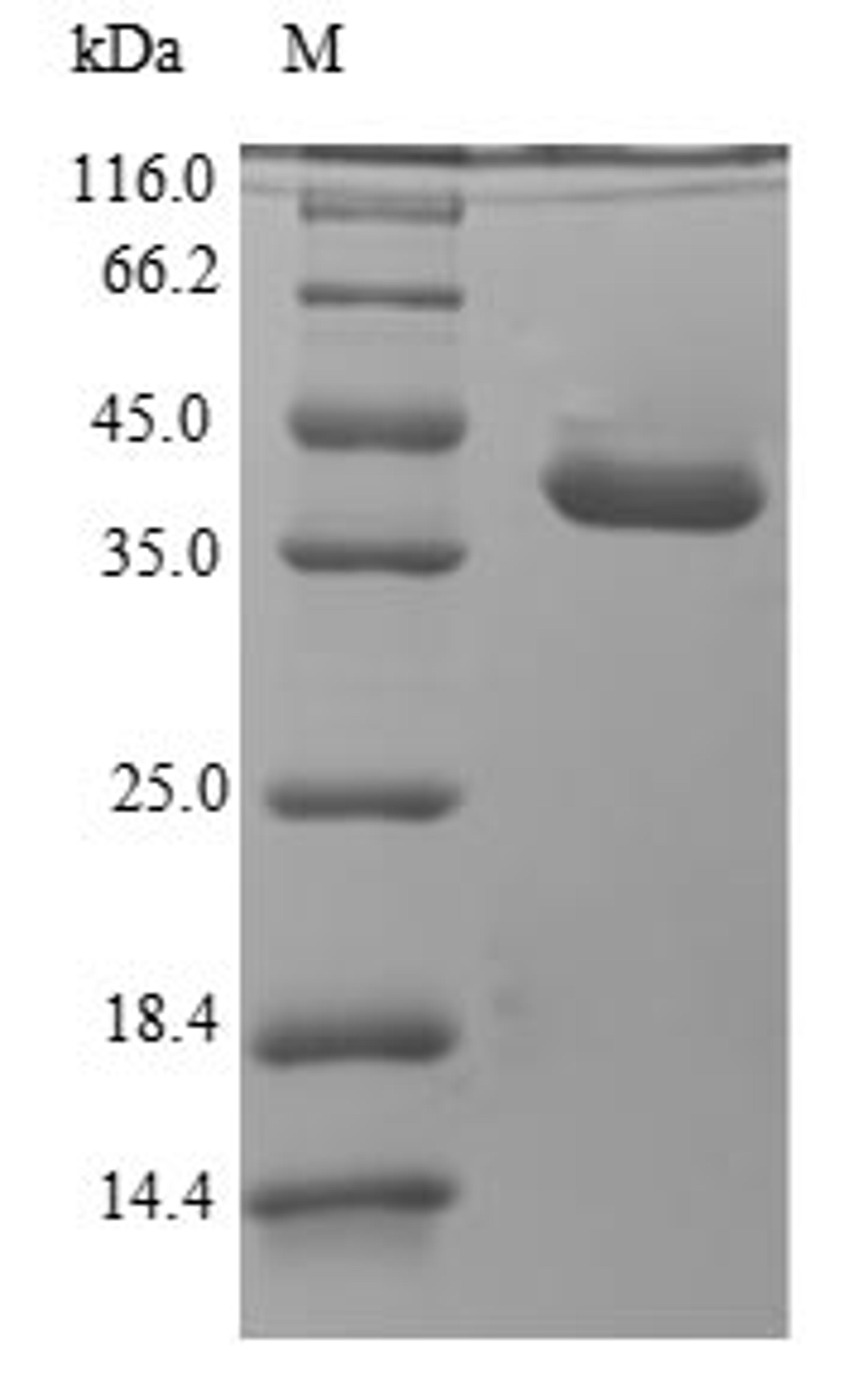 (Tris-Glycine gel) Discontinuous SDS-PAGE (reduced) with 5% enrichment gel and 15% separation gel.