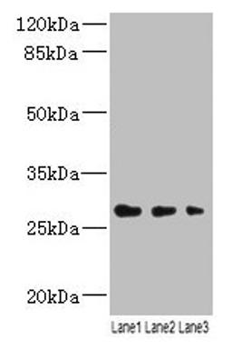 Western blot. All lanes: LRRC57 antibody at 4µg/ml. Lane 1: Mouse liver tissue. Lane 2: Mouse kidney tissue. Lane 3: Mouse lung tissue. Secondary. Goat polyclonal to rabbit IgG at 1/10000 dilution. Predicted band size: 27 kDa. Observed band size: 27 kDa