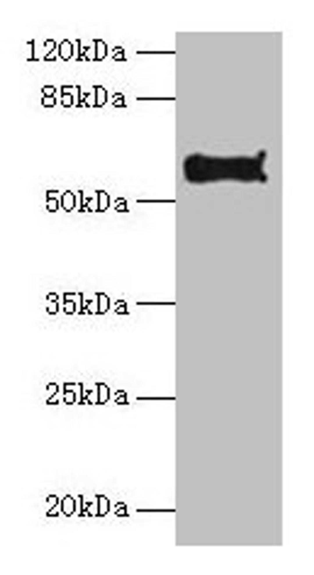 Western blot. All lanes: Pdia2 antibody at 10µg/ml + Hela whole cell lysate. Secondary. Goat polyclonal to rabbit IgG at 1/10000 dilution. Predicted band size: 59, 58 kDa. Observed band size: 59 kDa