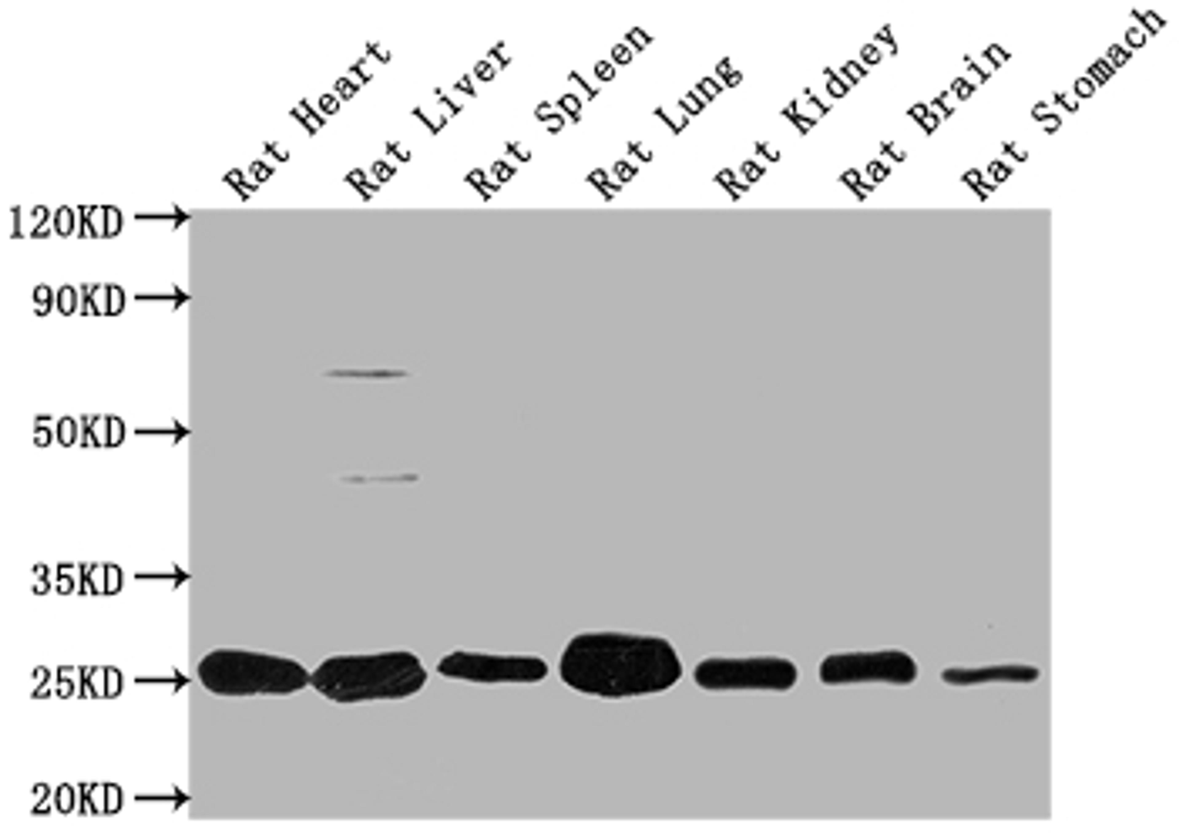 Western Blot. Positive WB detected in: Rat Heart tissue, Rat Liver tissue, Rat Spleen tissue, Rat Lung tissue, Rat Kidney tissue, Rat Brain tissue, Rat Stomach tissue. All lanes: Apoa1 antibody at 1:2000. Secondary. Goat polyclonal to rabbit IgG at 1/50000 dilution. Predicted band size: 31 kDa. Observed band size: 31 kDa. 