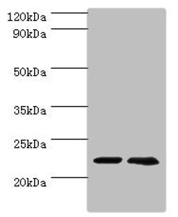 Western blot. All lanes: ASF1A antibody at 2µg/ml. Lane 1: Jurkat whole cell lysate. Lane 2: A431 whole cell lysate. Secondary. Goat polyclonal to rabbit IgG at 1/10000 dilution. Predicted band size: 23 kDa. Observed band size: 23 kDa