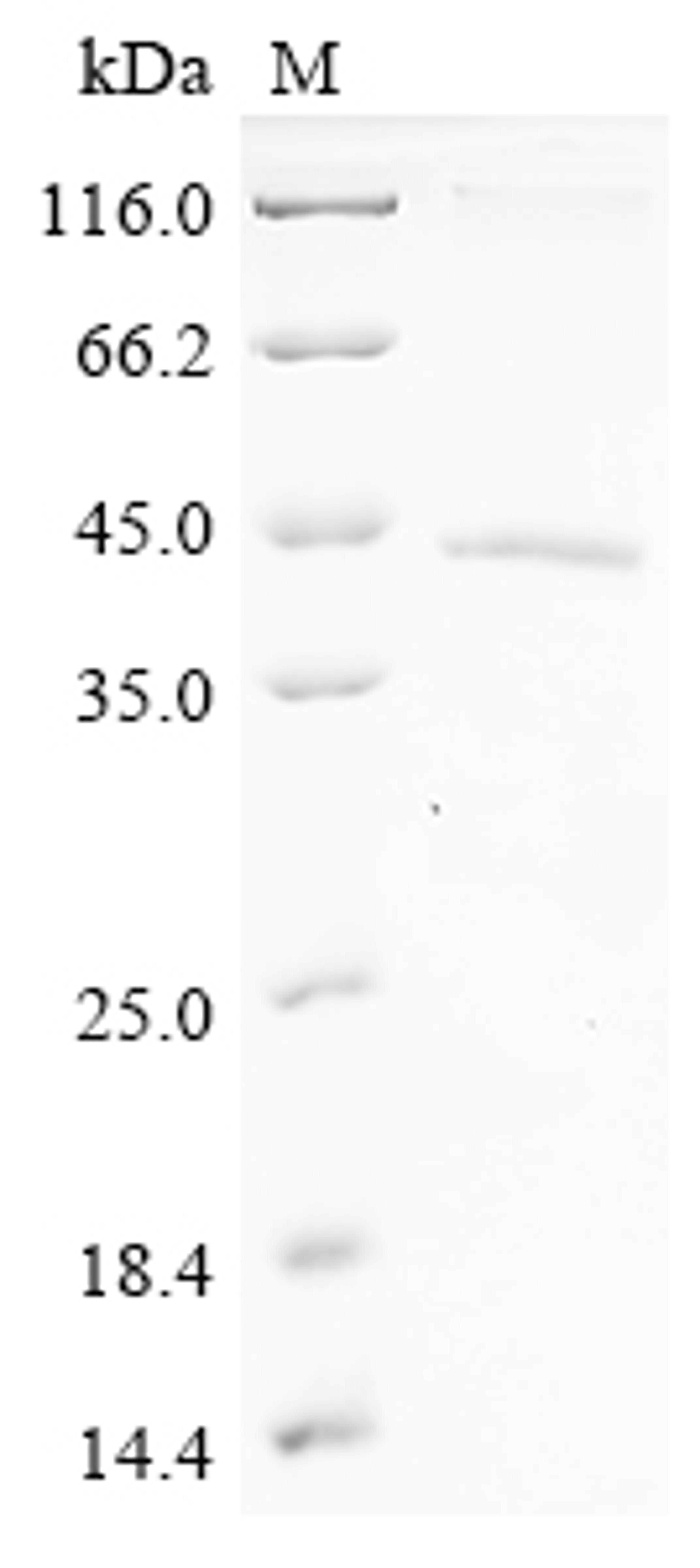 (Tris-Glycine gel) Discontinuous SDS-PAGE (reduced) with 5% enrichment gel and 15% separation gel.