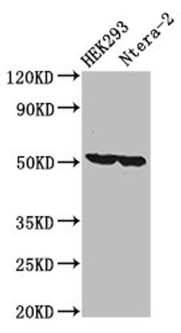 Western Blot. Positive WB detected in: HEK293 whole cell lysate, Ntera-2 whole cell lysate. All lanes: RUVBL1 antibody at 3.2ug/ml. Secondary. Goat polyclonal to rabbit IgG at 1/50000 dilution. Predicted band size: 51, 43 kDa. Observed band size: 51 kDa.