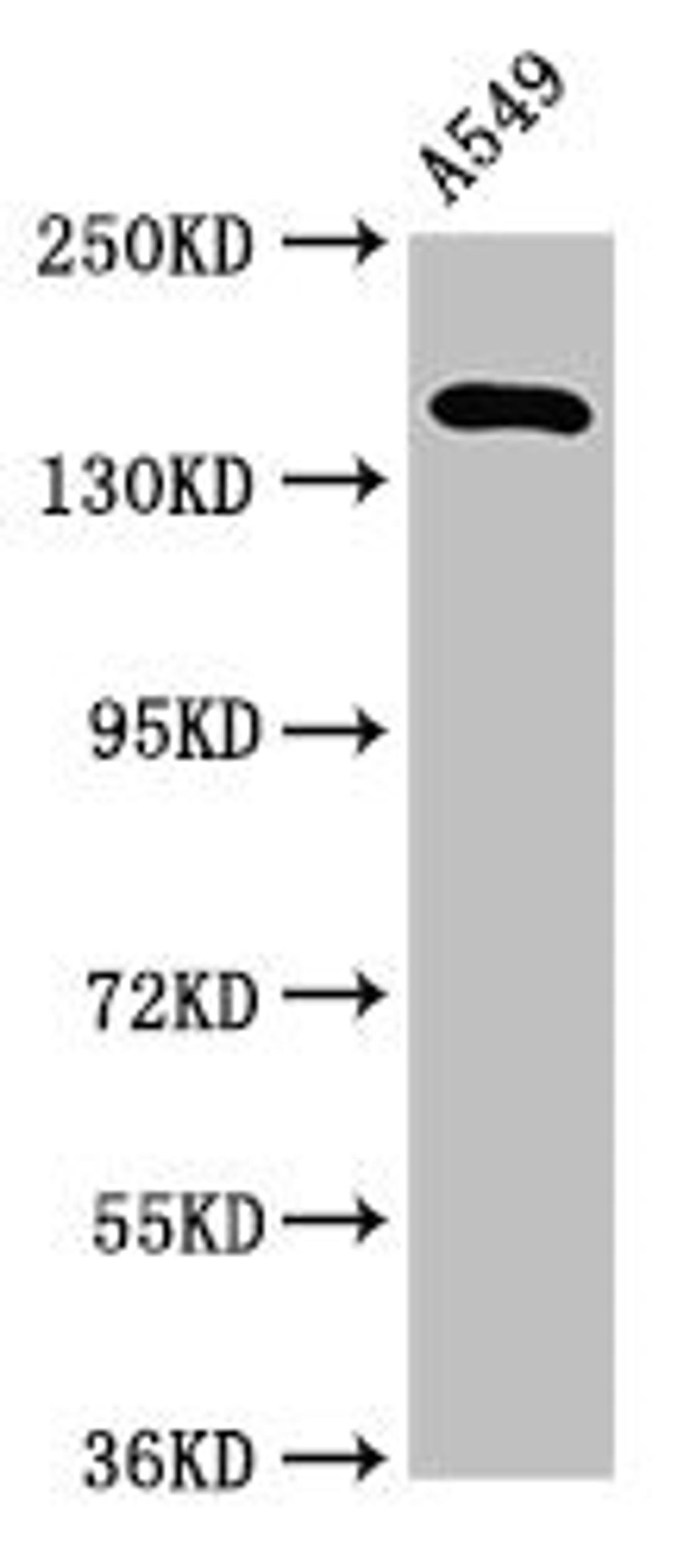 Western Blot. Positive WB detected in: A549 whole cell lysate. All lanes: A2ML1 antibody at 3.2µg/ml. Secondary. Goat polyclonal to rabbit IgG at 1/50000 dilution. Predicted band size: 162, 106 kDa. Observed band size: 162 kDa
