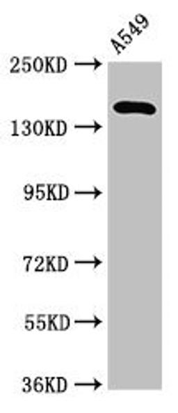 Western Blot. Positive WB detected in: A549 whole cell lysate. All lanes: A2ML1 antibody at 3.2µg/ml. Secondary. Goat polyclonal to rabbit IgG at 1/50000 dilution. Predicted band size: 162, 106 kDa. Observed band size: 162 kDa