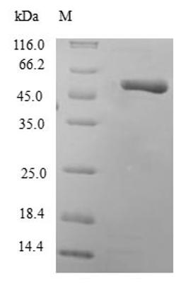 (Tris-Glycine gel) Discontinuous SDS-PAGE (reduced) with 5% enrichment gel and 15% separation gel.