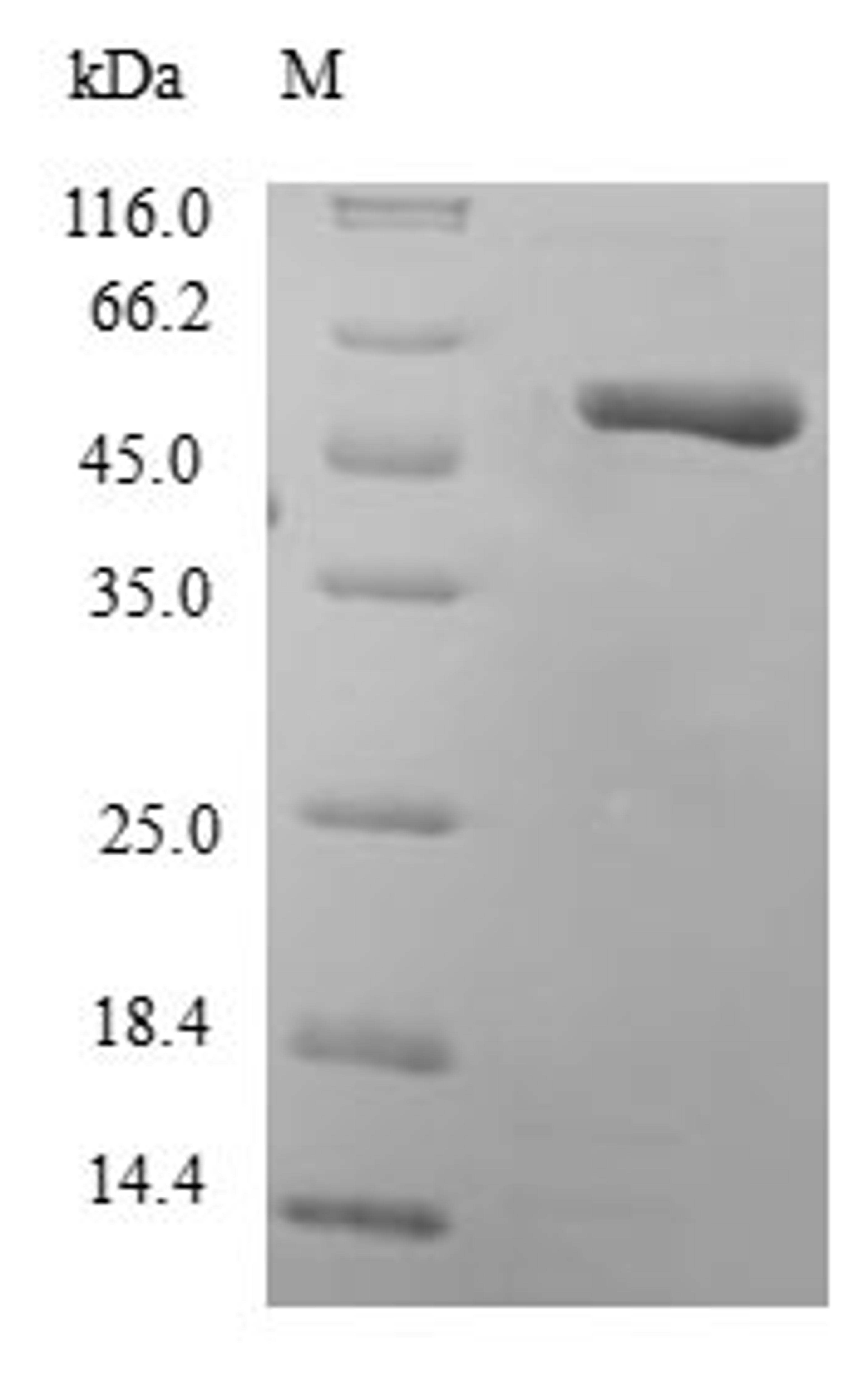 (Tris-Glycine gel) Discontinuous SDS-PAGE (reduced) with 5% enrichment gel and 15% separation gel.