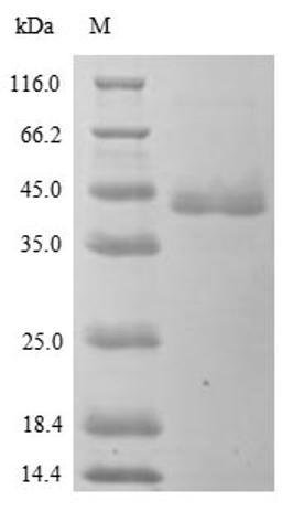 (Tris-Glycine gel) Discontinuous SDS-PAGE (reduced) with 5% enrichment gel and 15% separation gel.