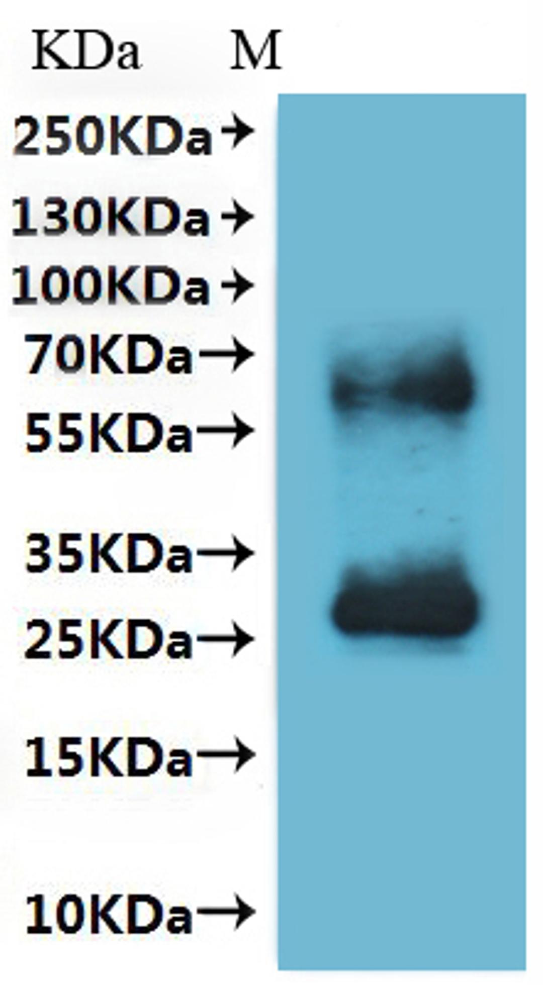 CSB-MP022728HU is detected by Mouse anti-6*His monoclonal antibody.