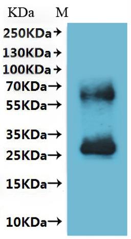 CSB-MP022728HU is detected by Mouse anti-6*His monoclonal antibody.