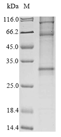 (Tris-Glycine gel) Discontinuous SDS-PAGE (reduced) with 5% enrichment gel and 15% separation gel.
