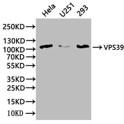 Western Blot. Positive WB detected in: Mouse heart tissue, Mouse kidney tissue. All lanes: VPS39 antibody at 3ug/ml. Secondary. Goat polyclonal to rabbit IgG at 1/50000 dilution. Predicted band size: 102, 101 kDa. Observed band size: 102 kDa. 