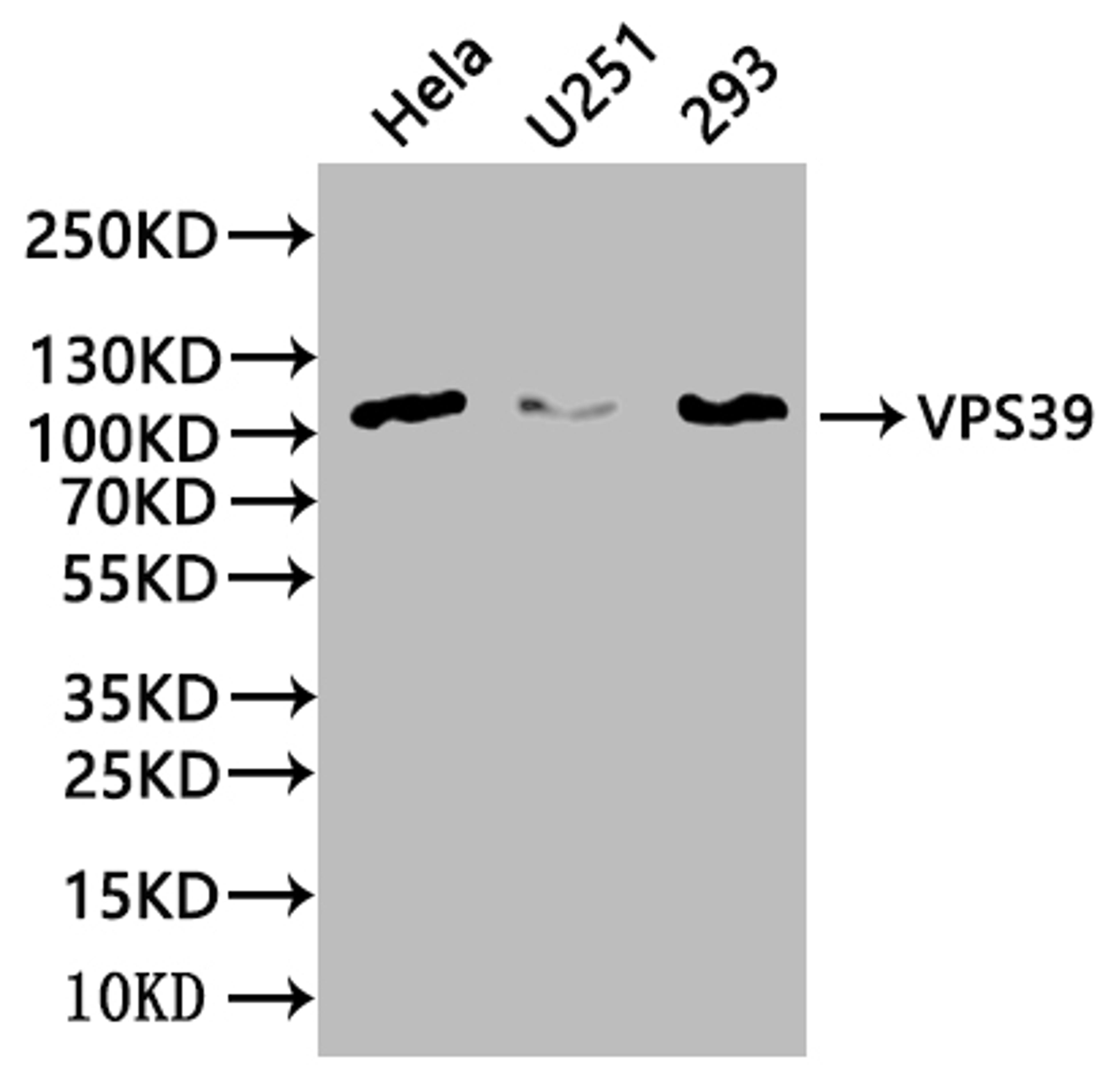 Western Blot. Positive WB detected in: Mouse heart tissue, Mouse kidney tissue. All lanes: VPS39 antibody at 3ug/ml. Secondary. Goat polyclonal to rabbit IgG at 1/50000 dilution. Predicted band size: 102, 101 kDa. Observed band size: 102 kDa. 