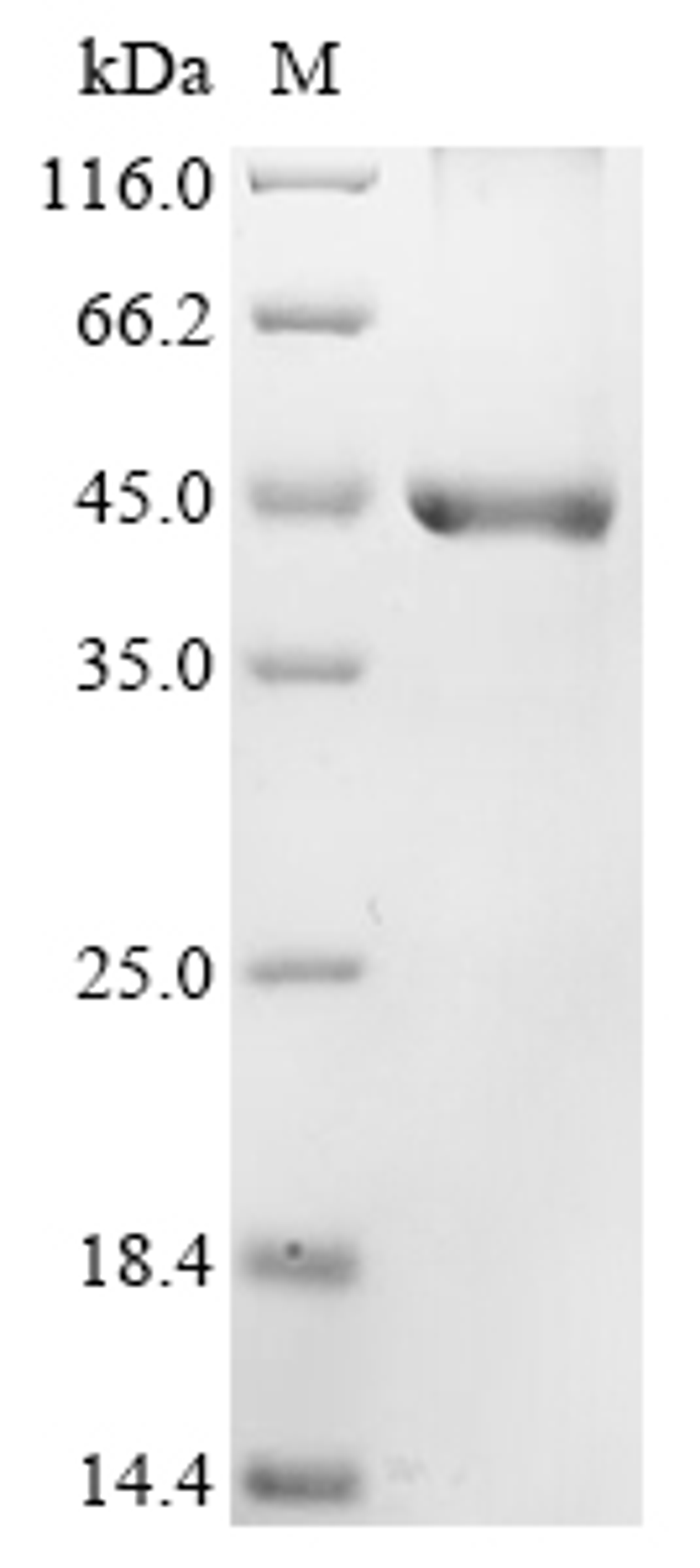 (Tris-Glycine gel) Discontinuous SDS-PAGE (reduced) with 5% enrichment gel and 15% separation gel.