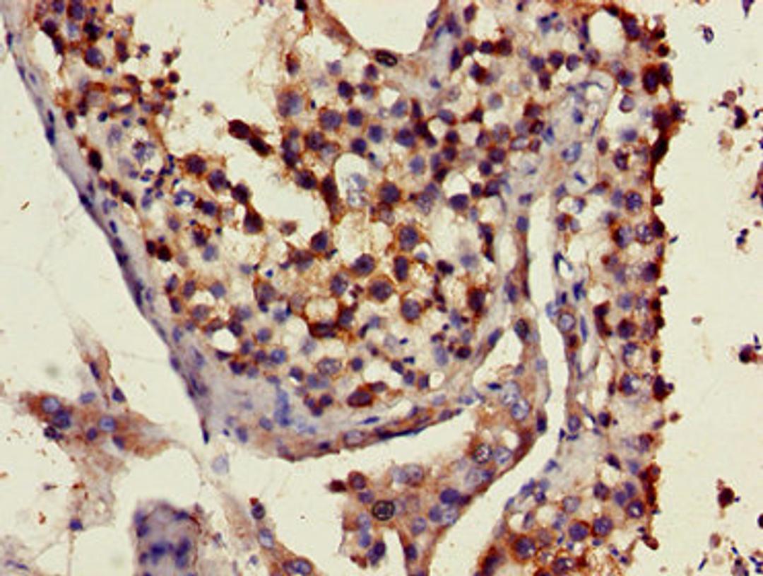 Immunohistochemistry of paraffin-embedded human testis tissue using CSB-PA622665LA01HU at dilution of 1:100