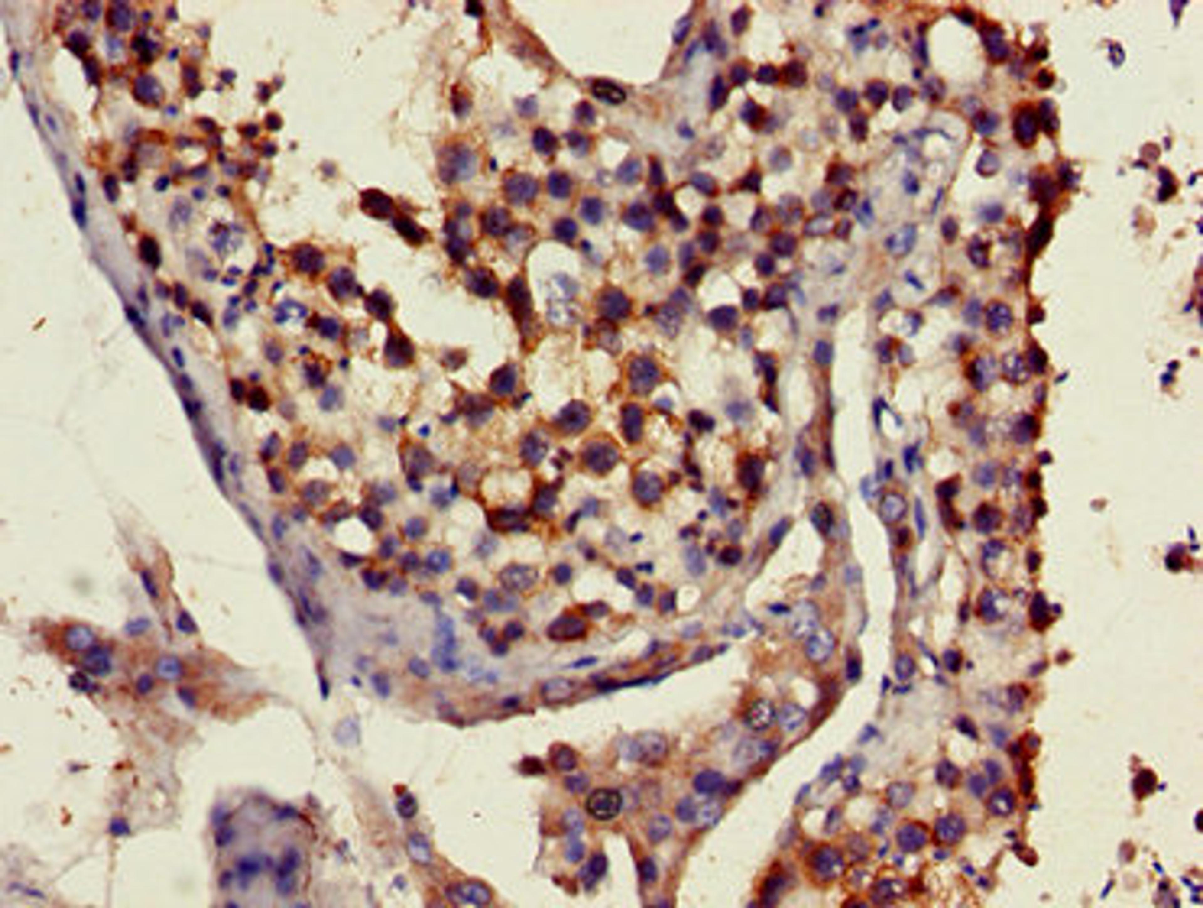 Immunohistochemistry of paraffin-embedded human testis tissue using CSB-PA622665LA01HU at dilution of 1:100