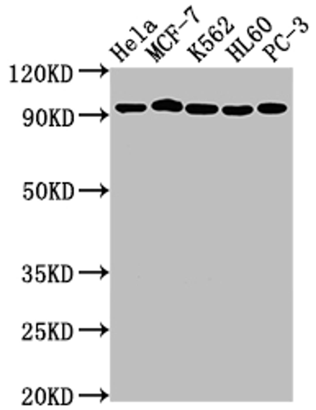 Western Blot. Positive WB detected in: Hela whole cell lysate, MCF-7 whole cell lysate, K562 whole cell lysate, HL60 whole cell lysate, PC-3 whole cell lysate. All lanes: TOP1 antibody at 1:2000. Secondary. Goat polyclonal to rabbit IgG at 1/50000 dilution. Predicted band size: 91 kDa. Observed band size: 91 kDa.