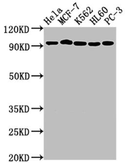 Western Blot. Positive WB detected in: Hela whole cell lysate, MCF-7 whole cell lysate, K562 whole cell lysate, HL60 whole cell lysate, PC-3 whole cell lysate. All lanes: TOP1 antibody at 1:2000. Secondary. Goat polyclonal to rabbit IgG at 1/50000 dilution. Predicted band size: 91 kDa. Observed band size: 91 kDa.