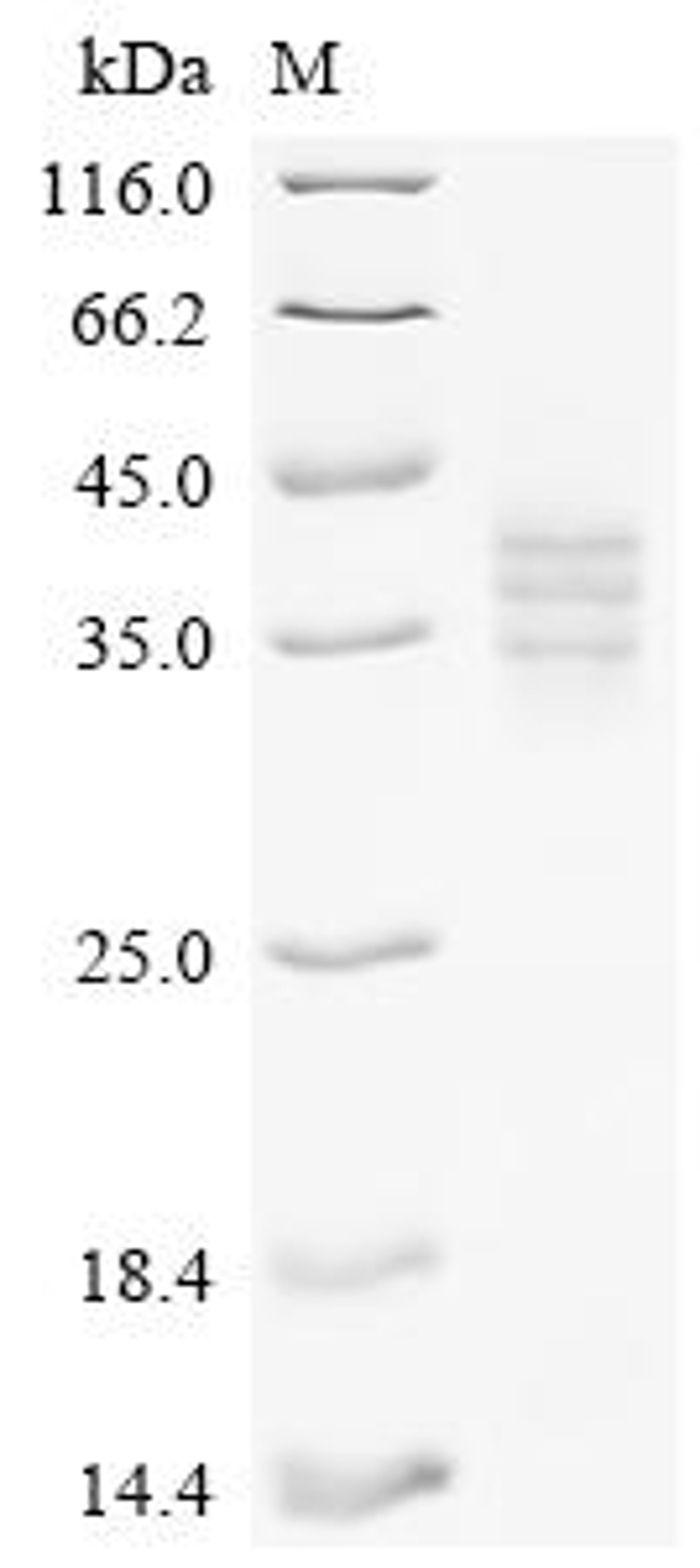 (Tris-Glycine gel) Discontinuous SDS-PAGE (reduced) with 5% enrichment gel and 15% separation gel.