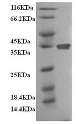 (Tris-Glycine gel) Discontinuous SDS-PAGE (reduced) with 5% enrichment gel and 15% separation gel.