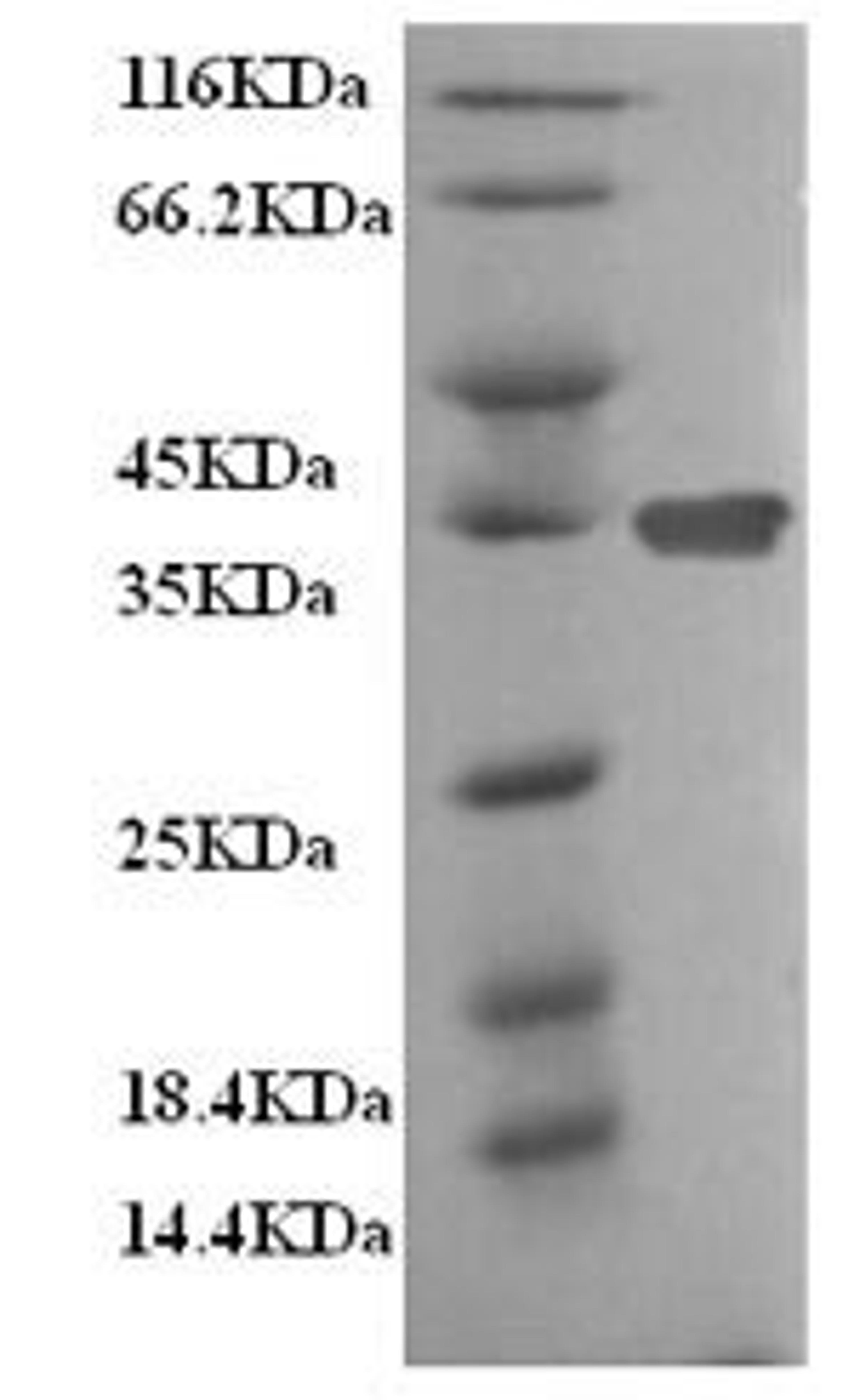 (Tris-Glycine gel) Discontinuous SDS-PAGE (reduced) with 5% enrichment gel and 15% separation gel.