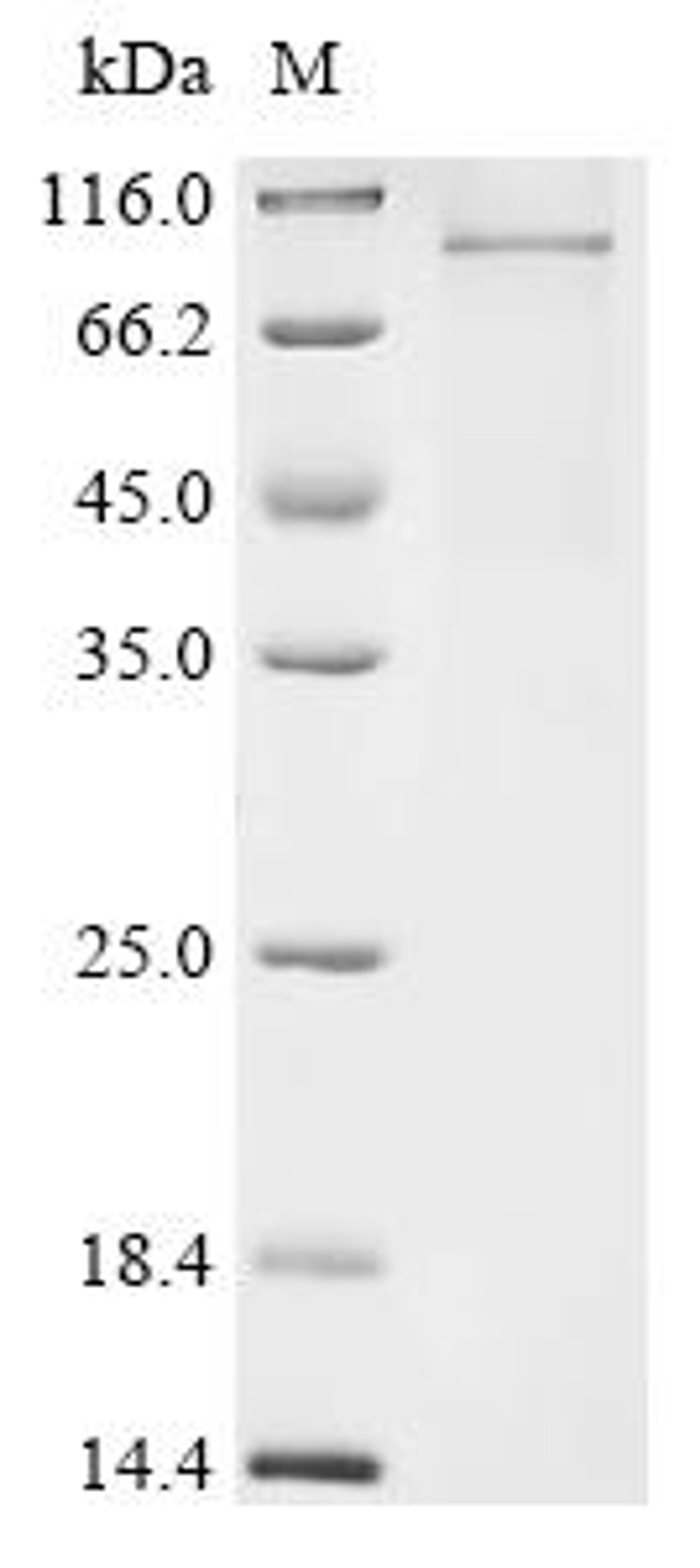 (Tris-Glycine gel) Discontinuous SDS-PAGE (reduced) with 5% enrichment gel and 15% separation gel.