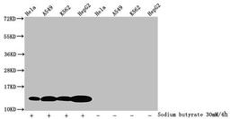 Western Blot. Detected samples: Hela whole cell lysate, A549 whole cell lysate, K562 whole cell lysate, HepG2 whole cell lysate; Untreated (-) or treated (+) with 30mM sodium butyrate for 4h. All lanes: HIST1H4A antibody at 1.25µg/ml. Secondary. Goat polyclonal to rabbit IgG at 1/50000 dilution. Predicted band size: 12 kDa. Observed band size: 12 kDa