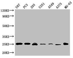 Western Blot. Positive WB detected in: U87 whole cell lysate, PC3 whole cell lysate, 293 whole cell lysate, U251 whole cell lysate, A549 whole cell lysate, A375 whole cell lysate, MG-63 whole cell lysate . All lanes CD9 antibody at 1:2000. Secondary. Goat polyclonal to mouse IgG at 1/50000 dilution. Predicted band size: 25 KDa. Observed band size: 25 KDa. Exposure time：5min