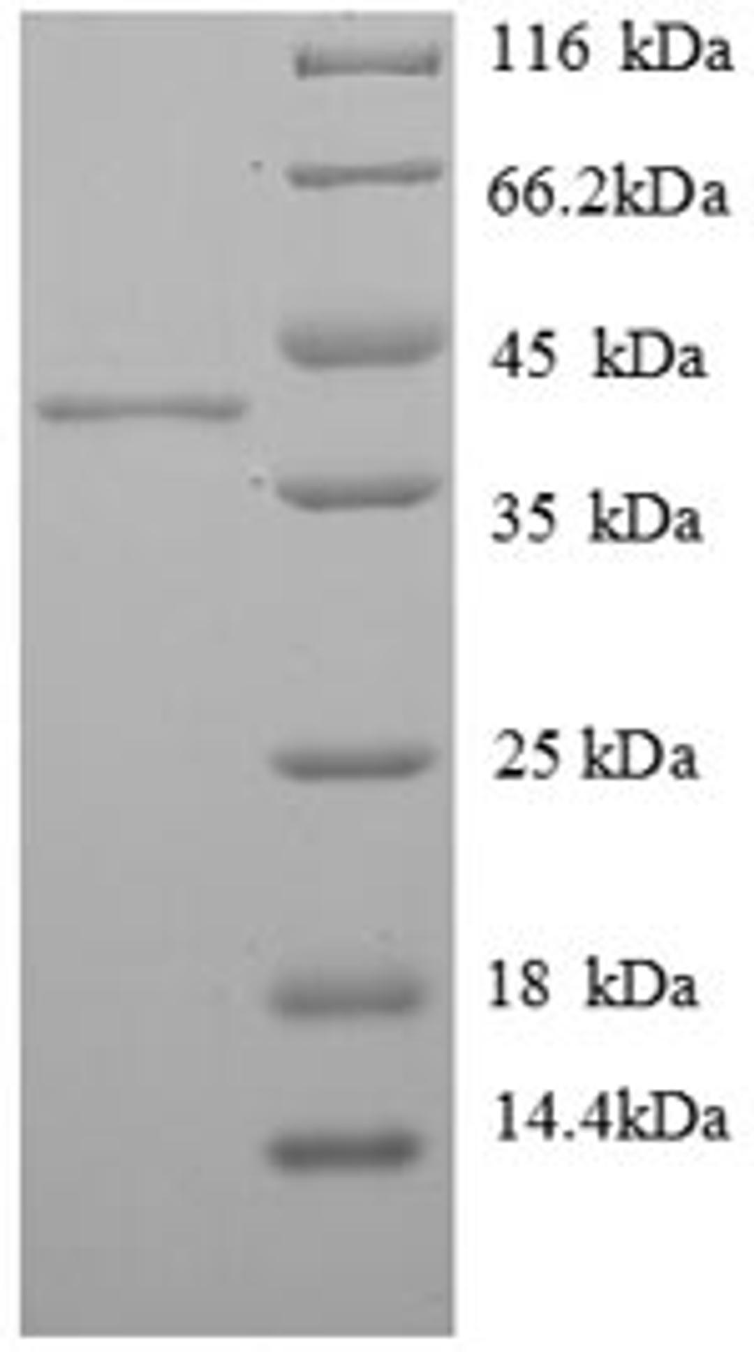 (Tris-Glycine gel) Discontinuous SDS-PAGE (reduced) with 5% enrichment gel and 15% separation gel.