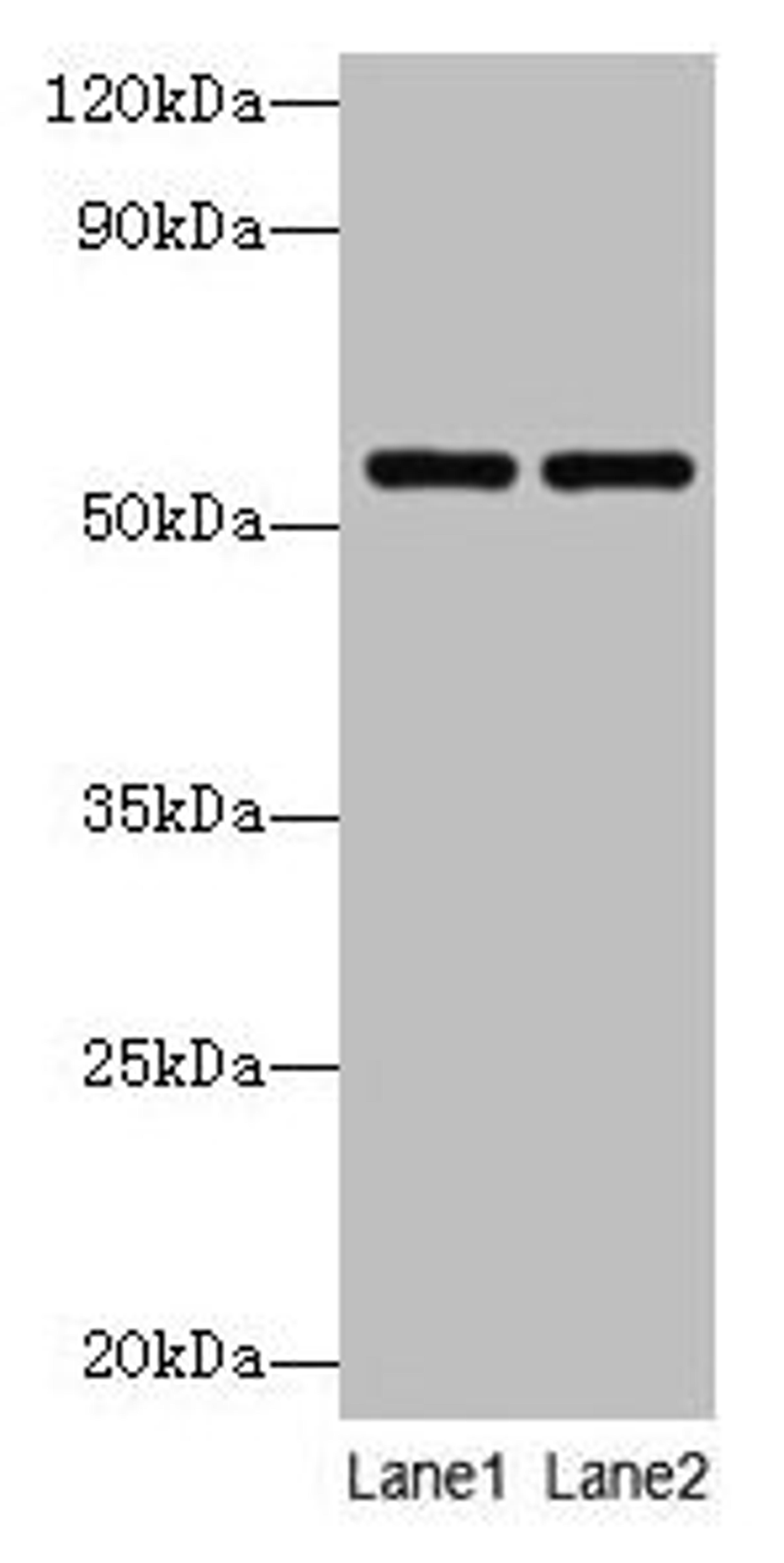 Western blot. All lanes: PHGDH antibody at 2µg/ml. Lane 1: EC109 whole cell lysate. Lane 2: 293T whole cell lysate. Secondary. Goat polyclonal to rabbit IgG at 1/10000 dilution. Predicted band size: 57 kDa. Observed band size: 57 kDa