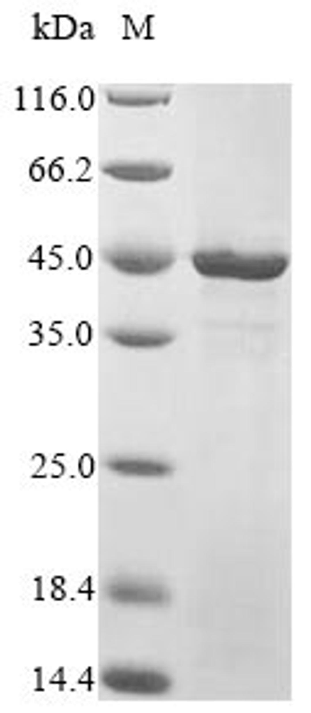 (Tris-Glycine gel) Discontinuous SDS-PAGE (reduced) with 5% enrichment gel and 15% separation gel.