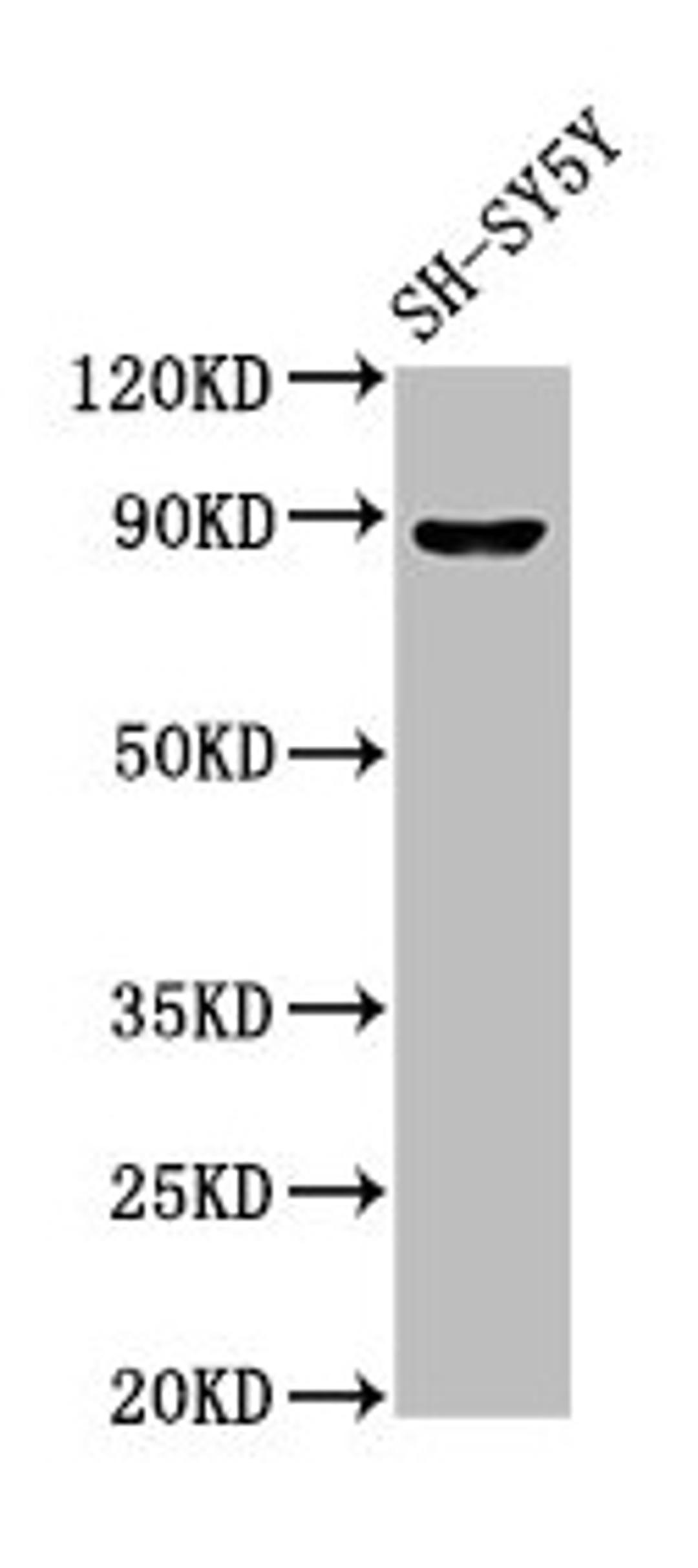 Western Blot. Positive WB detected in: SH-SY5Y whole cell lysate. All lanes: NPAS4 antibody at 7µg/ml. Secondary. Goat polyclonal to rabbit IgG at 1/50000 dilution. Predicted band size: 88, 26 kDa. Observed band size: 88 kDa