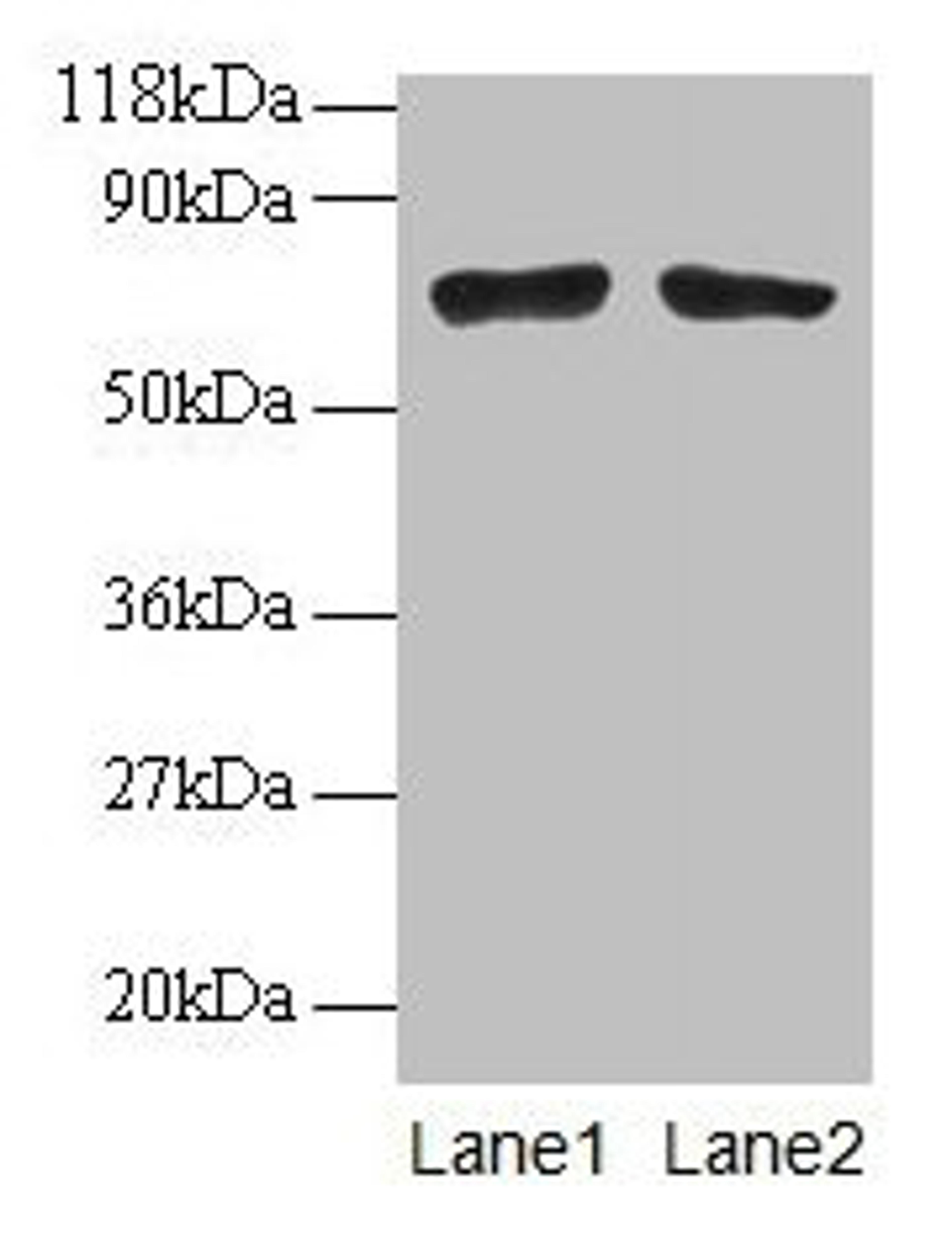 Western blot. All lanes: BMI1 antibodyt 2µg/ml. Lane 1: EC109 whole cell lysate. Lane 2: 293T whole cell lysate. Secondary. Goat polyclonal to rabbit IgG at 1/15000 dilution. Predicted band size: 37 kDa. Observed band size: 70 kDa
