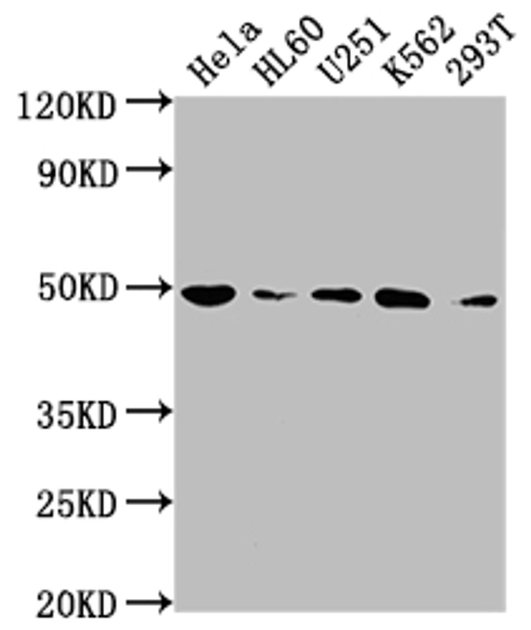 Western Blot. Positive WB detected in: Hela whole cell lysate, HL60 whole cell lysate, U251 whole cell lysate, K562 whole cell lysate, 293T whole cell lysate. All lanes: HDAC3 antibody at 1:2000. Secondary. Goat polyclonal to rabbit IgG at 1/50000 dilution. Predicted band size: 49, 50 kDa. Observed band size: 49 kDa. 