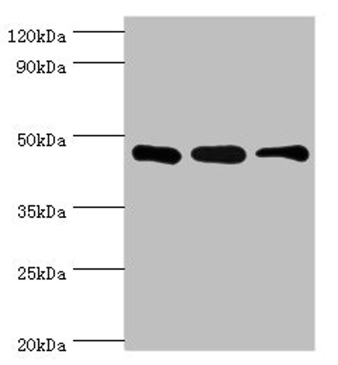 Western blot. All lanes: SUGCT antibody at 16ug/ml. Lane 1: Mouse skeletal muscle tissue. Lane 2: Mouse liver tissue. Lane 3: Mouse kidney tissue. Secondary. Goat polyclonal to rabbit IgG at 1/10000 dilution. Predicted band size: 49, 48, 52, 44 kDa. Observed band size: 42 kDa. 