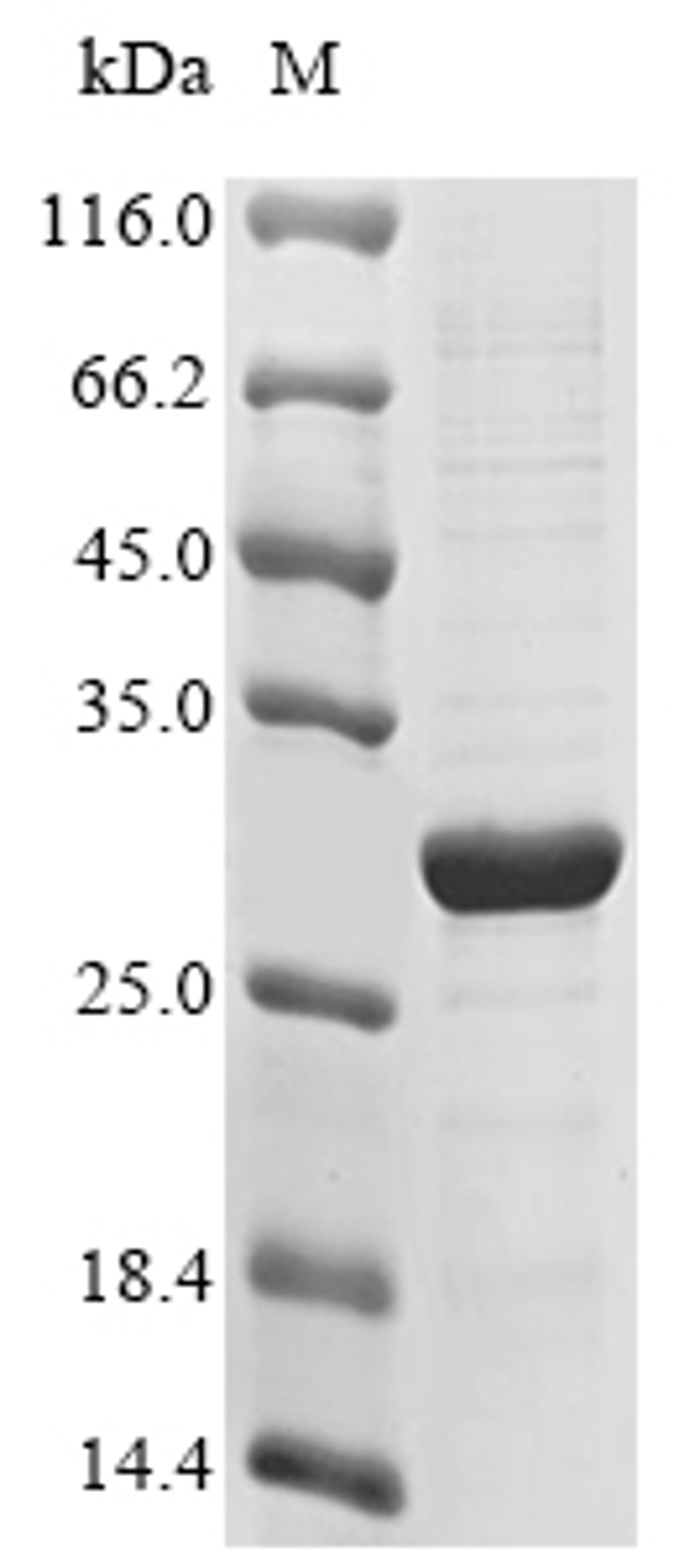 (Tris-Glycine gel) Discontinuous SDS-PAGE (reduced) with 5% enrichment gel and 15% separation gel.