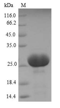 (Tris-Glycine gel) Discontinuous SDS-PAGE (reduced) with 5% enrichment gel and 15% separation gel.