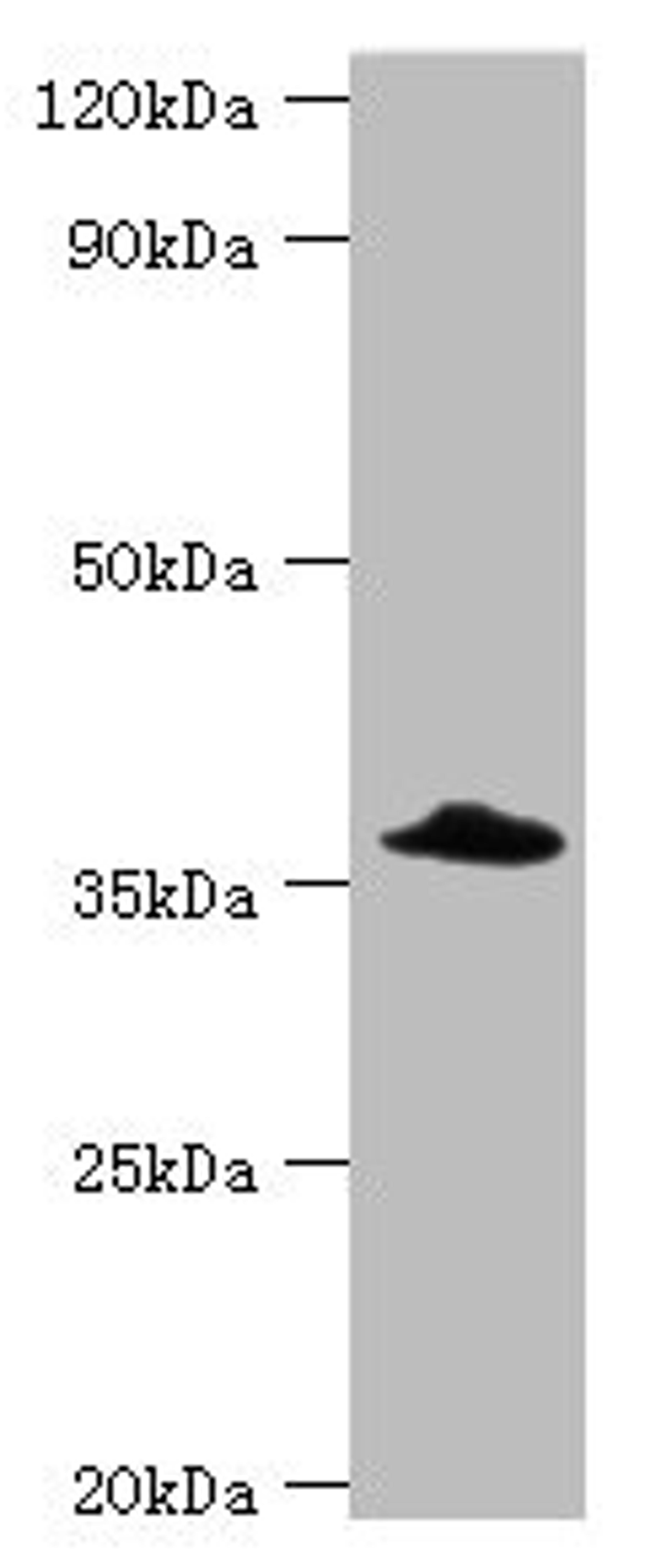 Western blot. All lanes: Complement factor H-related protein 3 antibody at 6ug/ml + Rat heart tissue. Secondary. Goat polyclonal to rabbit IgG at 1/10000 dilution. Predicted band size: 38, 31 kDa. Observed band size: 38 kDa. 