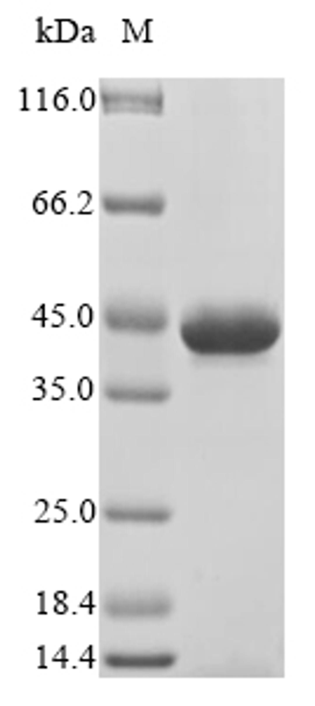 (Tris-Glycine gel) Discontinuous SDS-PAGE (reduced) with 5% enrichment gel and 15% separation gel.