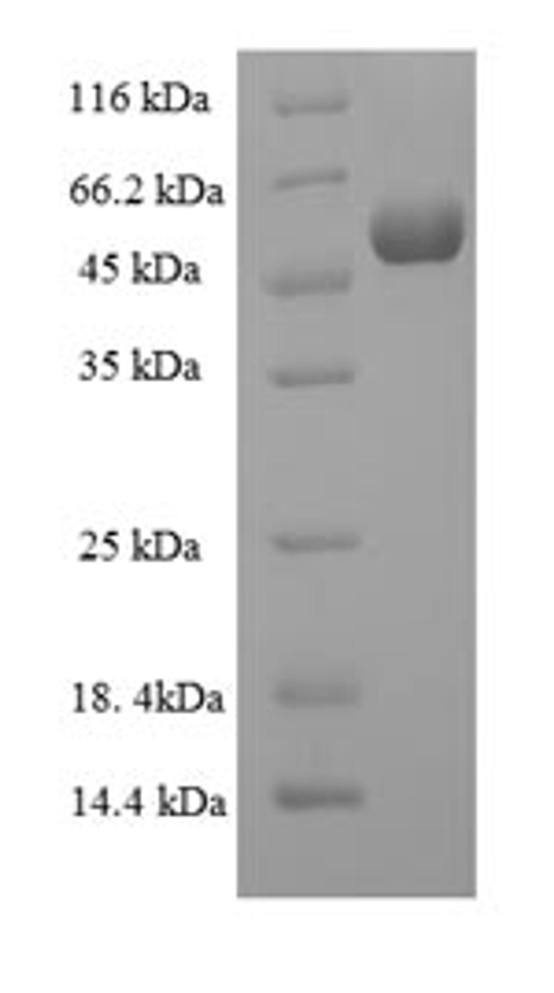 (Tris-Glycine gel) Discontinuous SDS-PAGE (reduced) with 5% enrichment gel and 15% separation gel.