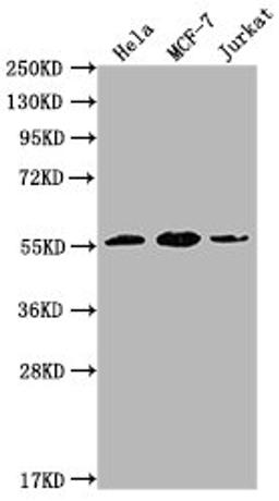 Western Blot. Positive WB detected in: Hela whole cell lysate, MCF-7 whole cell lysate, Jurkat whole cell lysate. All lanes: PKM antibody at 1:1000. Secondary. Goat polyclonal to Mouse IgG at 1/10000 dilution. Predicted band size: 58 kDa. Observed band size: 58 KDa. Exposure time: 1min