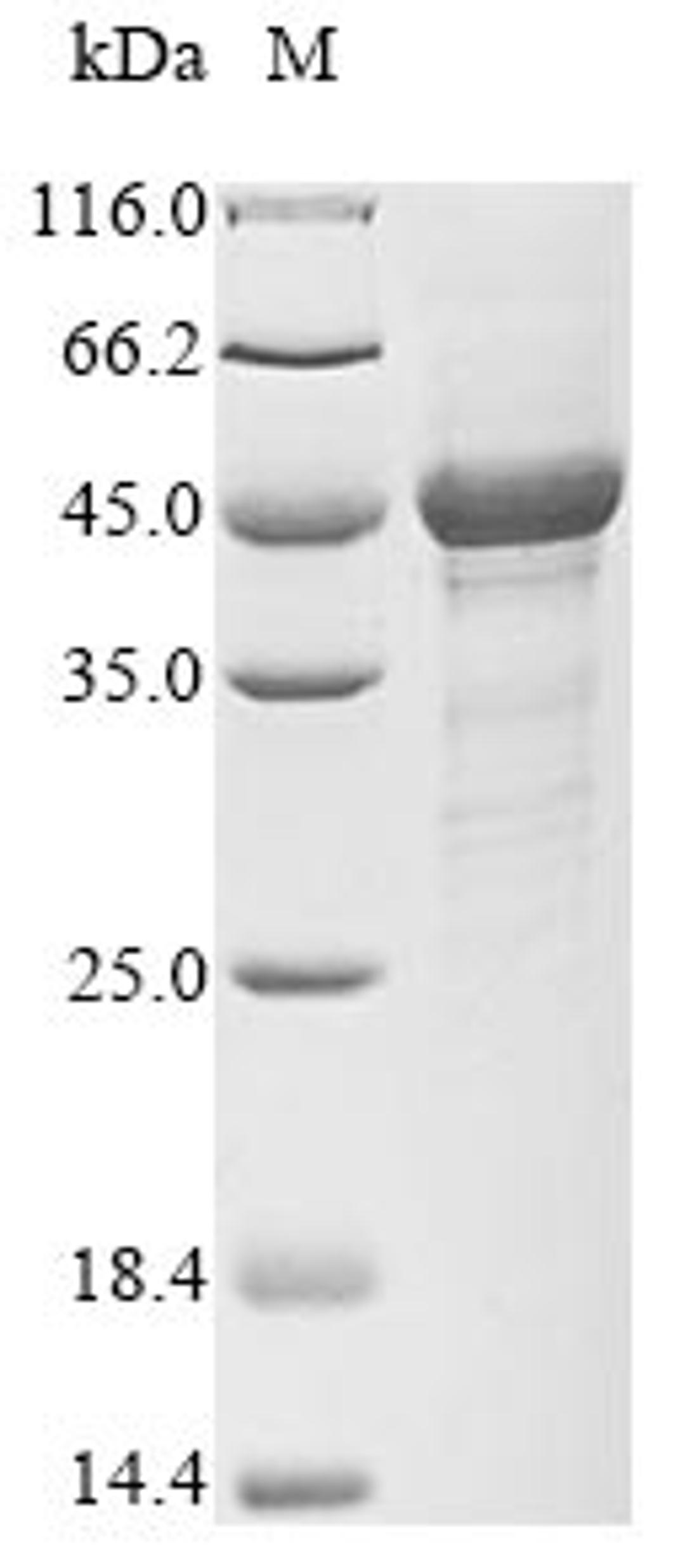(Tris-Glycine gel) Discontinuous SDS-PAGE (reduced) with 5% enrichment gel and 15% separation gel.