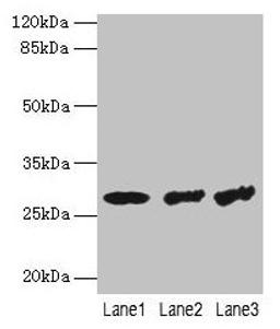 Western blot. All lanes: TBCB antibody at 4µg/ml. Lane 1: Hela whole cell lysate. Lane 2: A549 whole cell lysate. Lane 3: Jurkat whole cell lysate. Secondary. Goat polyclonal to rabbit IgG at 1/10000 dilution. Predicted band size: 28, 22 kDa. Observed band size: 28 kDa