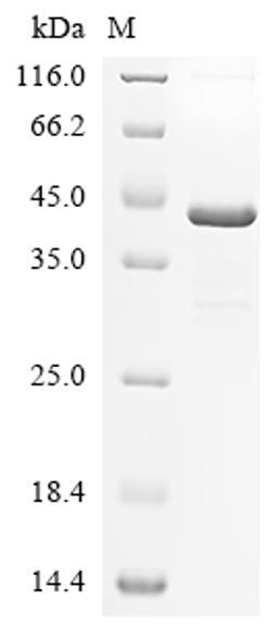(Tris-Glycine gel) Discontinuous SDS-PAGE (reduced) with 5% enrichment gel and 15% separation gel.