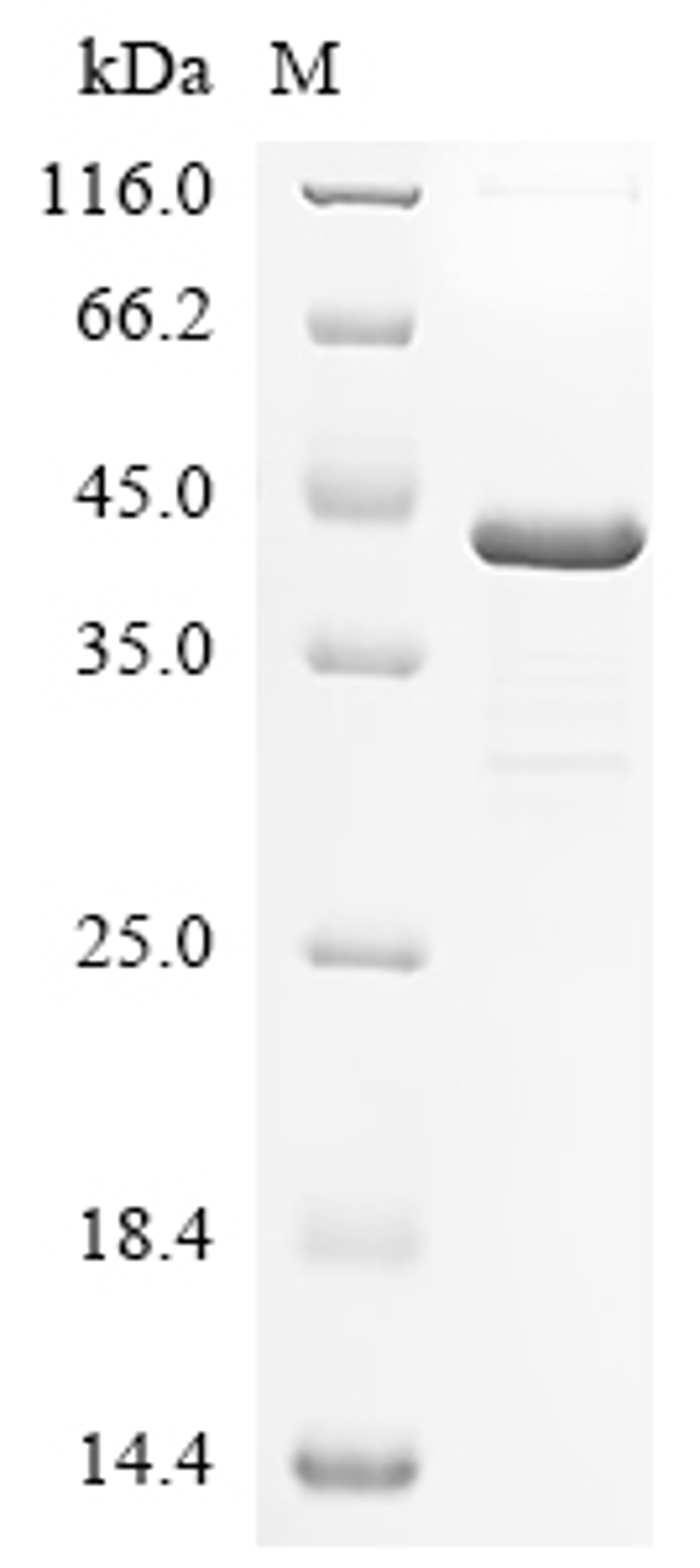 (Tris-Glycine gel) Discontinuous SDS-PAGE (reduced) with 5% enrichment gel and 15% separation gel.