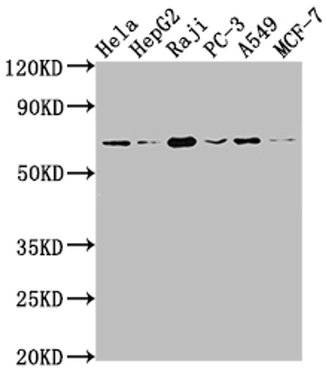 Western Blot. Positive WB detected in: Hela whole cell lysate, HepG2 whole cell lysate, Raji whole cell lysate, PC-3 whole cell lysate, A549 whole cell lysate, MCF-7 whole cell lysate. All lanes: ALAS1 antibody at 1:1500. Secondary. Goat polyclonal to rabbit IgG at 1/50000 dilution. Predicted band size: 71, 13 kDa. Observed band size: 71 kDa. 