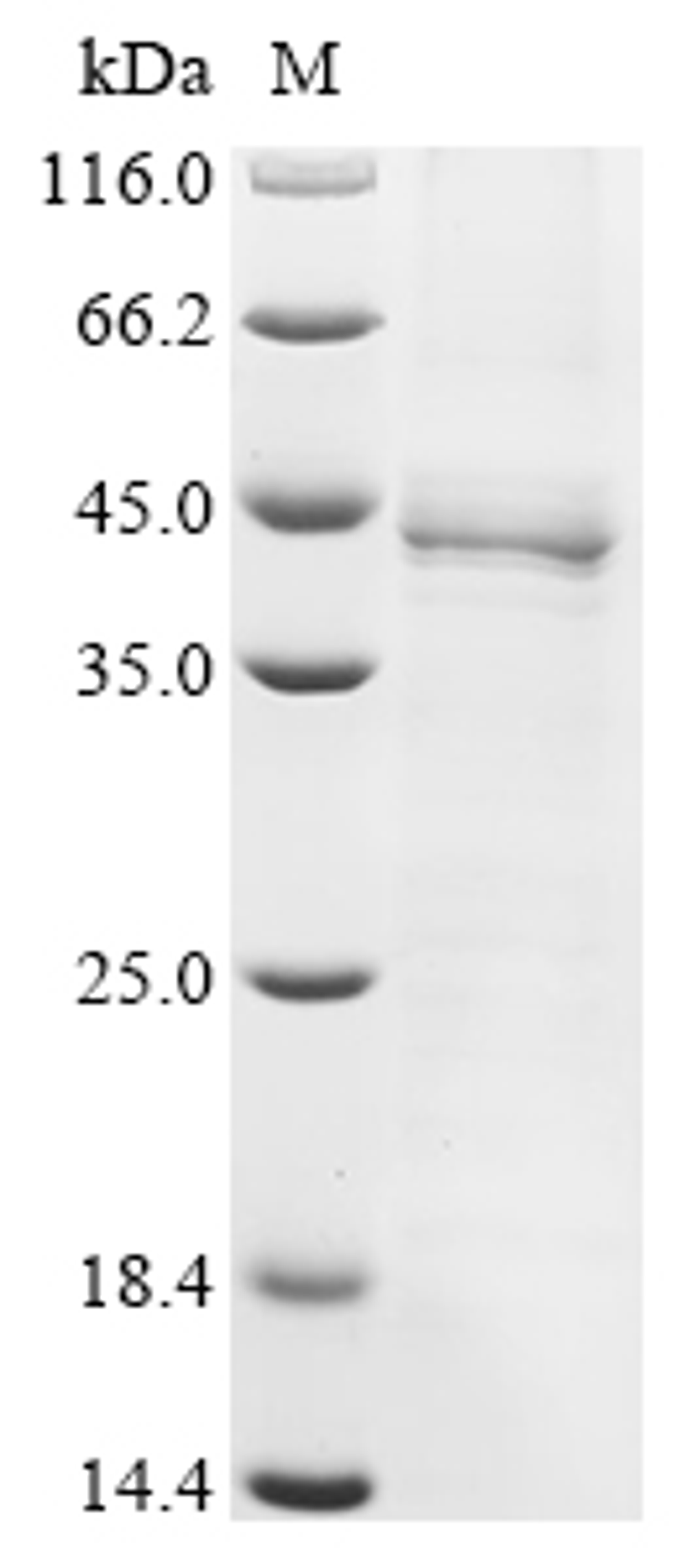 (Tris-Glycine gel) Discontinuous SDS-PAGE (reduced) with 5% enrichment gel and 15% separation gel.