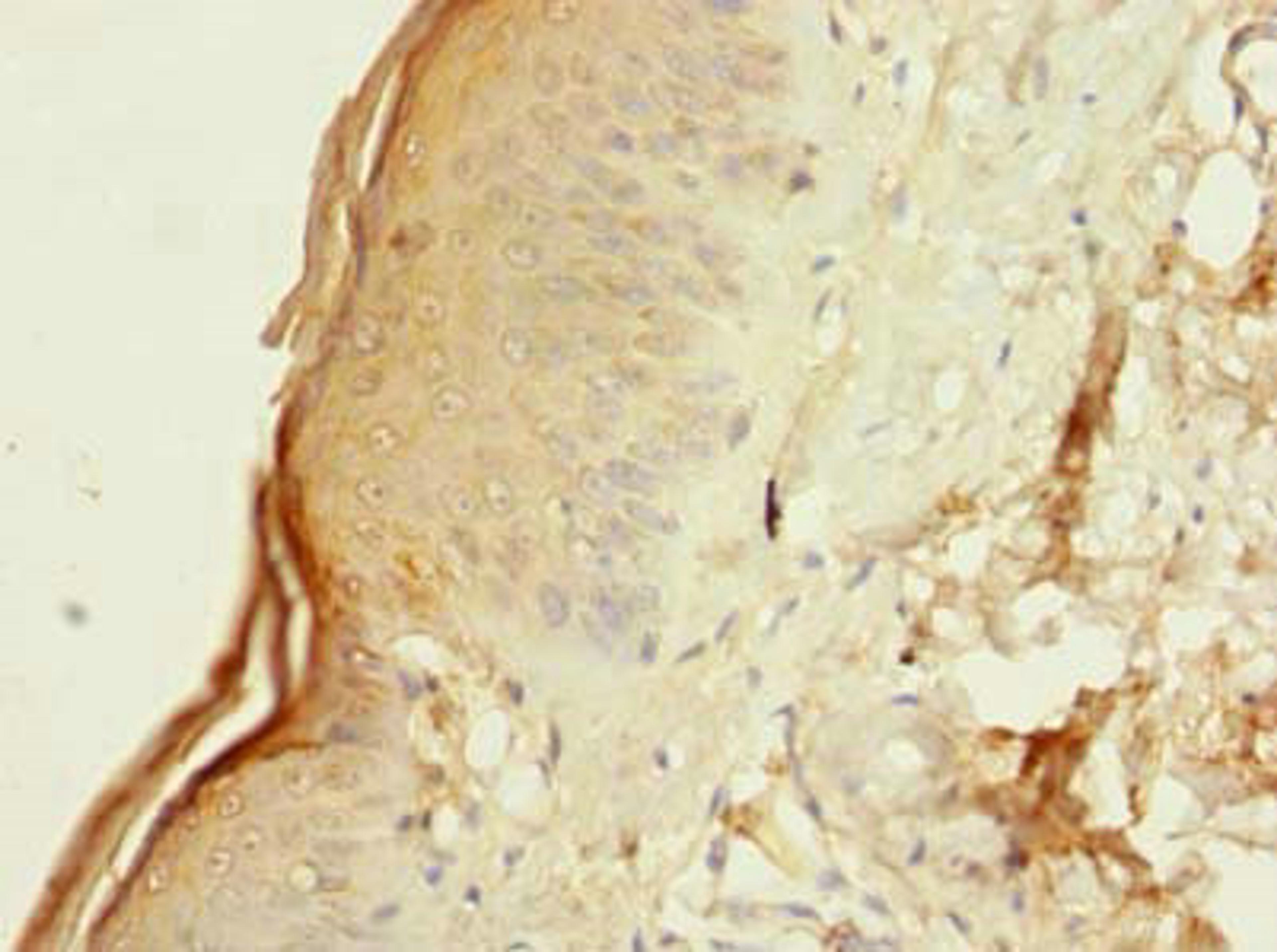 Immunohistochemistry of paraffin-embedded human skin tissue using CSB-PA017952HA01HU at dilution of 1:100