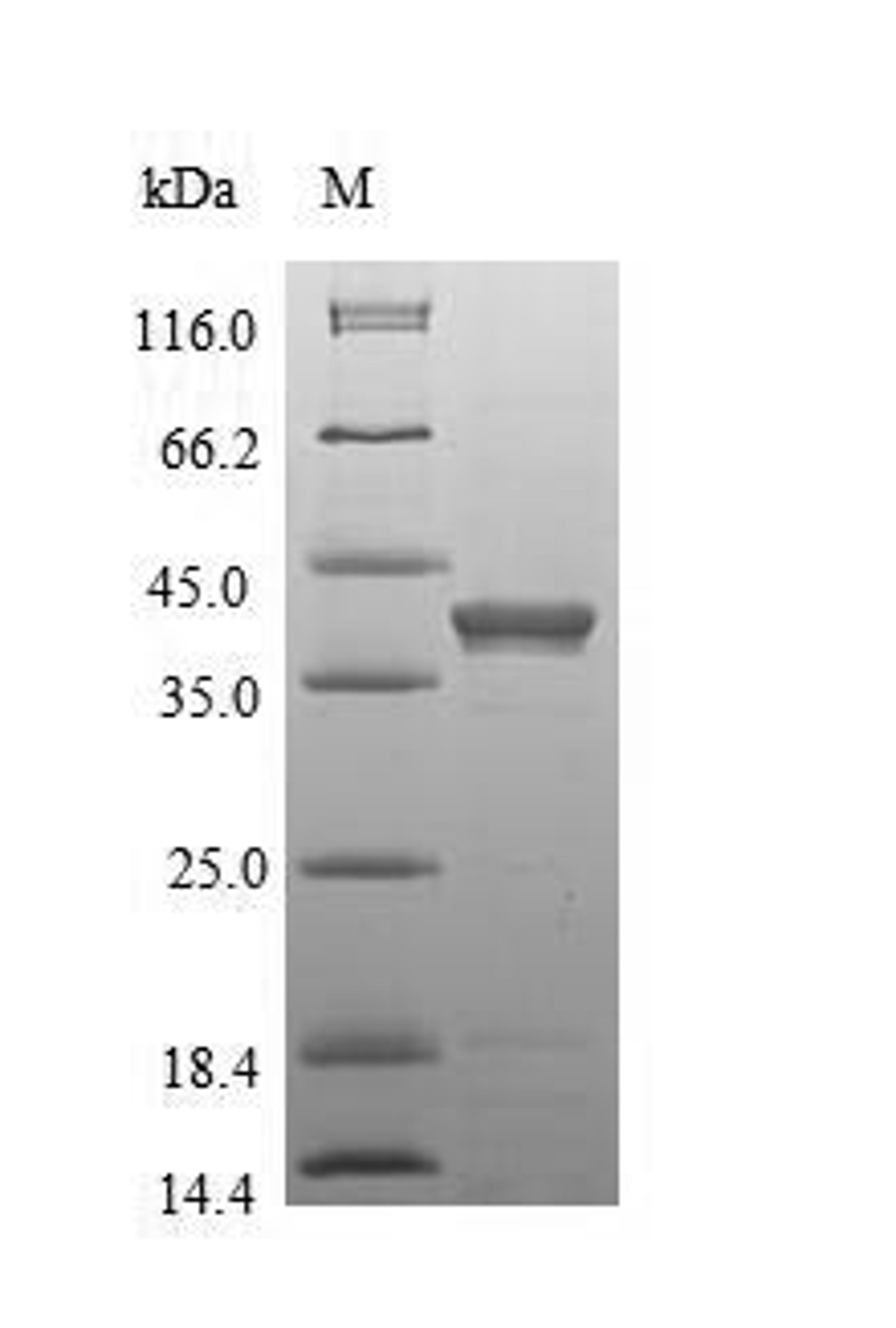 (Tris-Glycine gel) Discontinuous SDS-PAGE (reduced) with 5% enrichment gel and 15% separation gel.